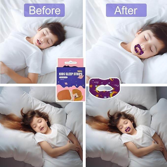 Anti Snoring Lips Strip 30 pcs - ZEDIF